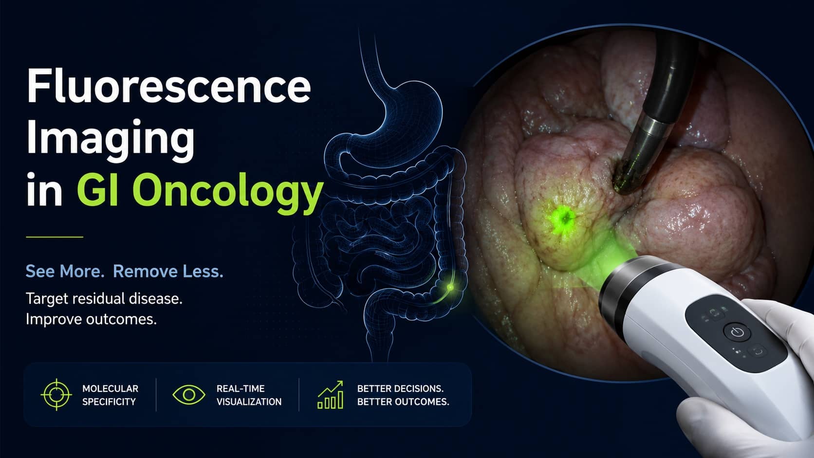 Fluorescence-Guided Molecular Imaging in GI Oncology: What the AGA Lumicell Spotlight Signals for Future Cancer Resection