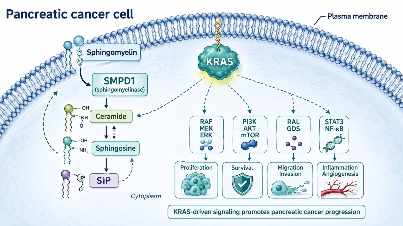 Sphingolipid Metabolism and KRAS in Pancreatic Cancer: A New Translational Signal