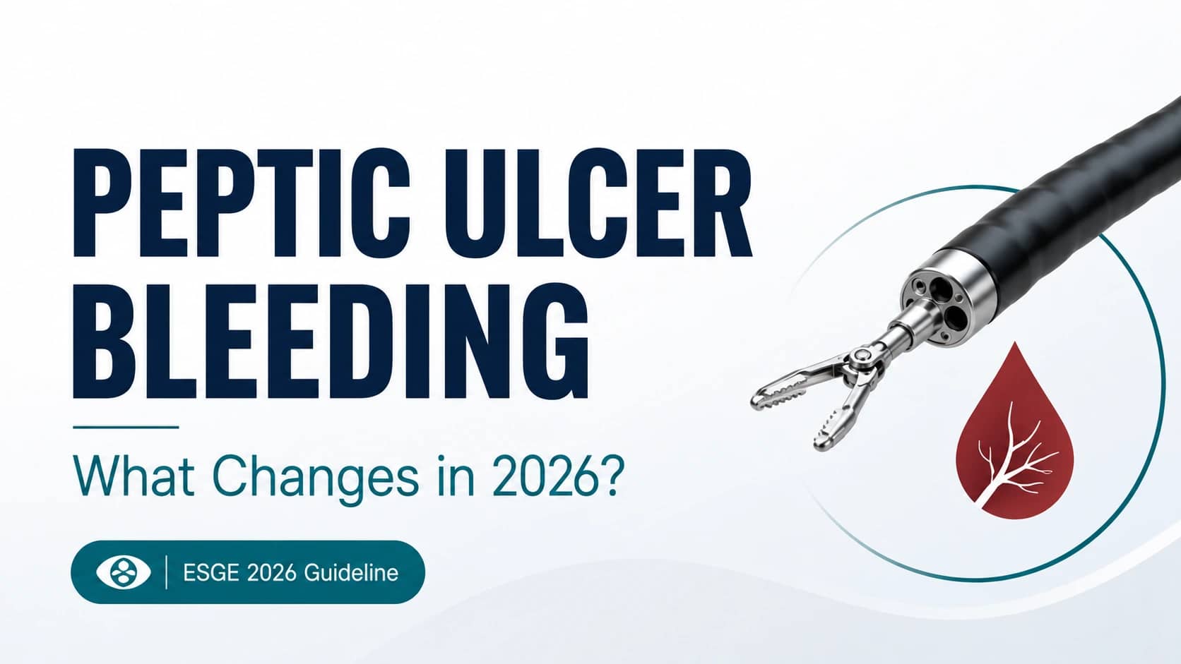 ESGE 2026 Guideline on Peptic Ulcer Bleeding: Key Updates for Endoscopists and GI Teams