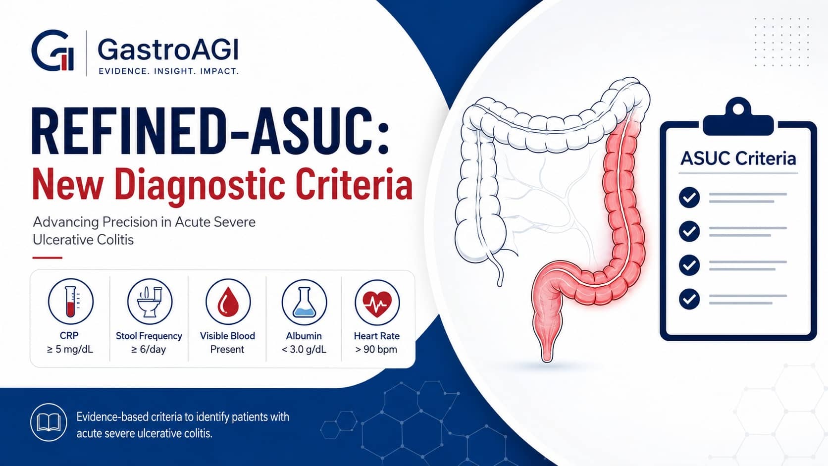 New Diagnostic Criteria for Acute Severe Ulcerative Colitis: REFINED-ASUC Consensus for the Modern Treatment Era