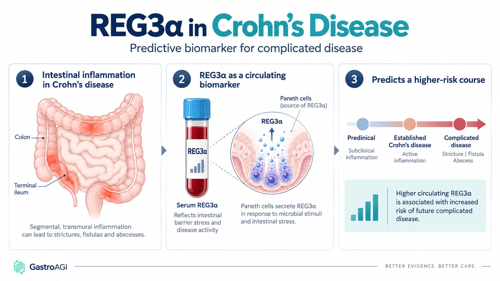 REG3α in Crohn’s Disease: A Promising Biomarker for Predicting Complicated Disease Before and After Diagnosis