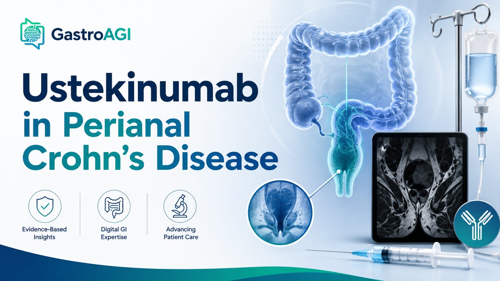 Ustekinumab for Fistulising Perianal Crohn’s Disease: What the GETAID Trial Adds to Clinical Practice