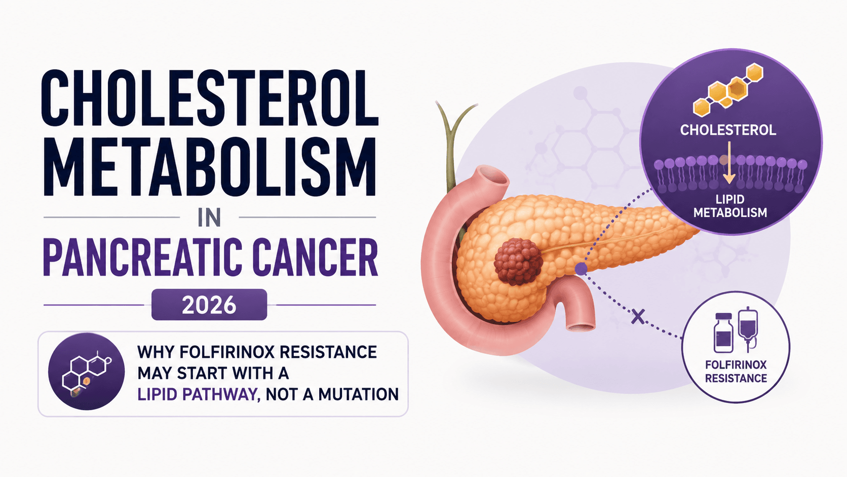 Cholesterol Metabolism in Pancreatic Cancer 2026: Why FOLFIRINOX Resistance May Start With a Lipid Pathway, Not a Mutation