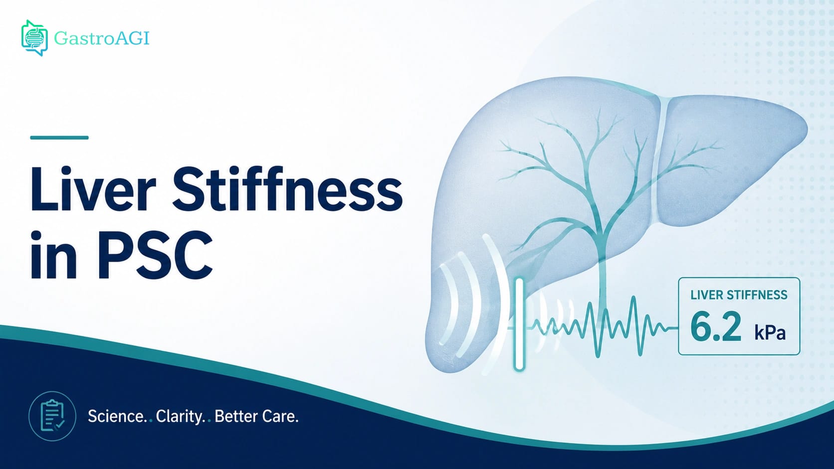 Liver Stiffness in Primary Sclerosing Cholangitis: Can Annual FibroScan Improve Risk Stratification?
