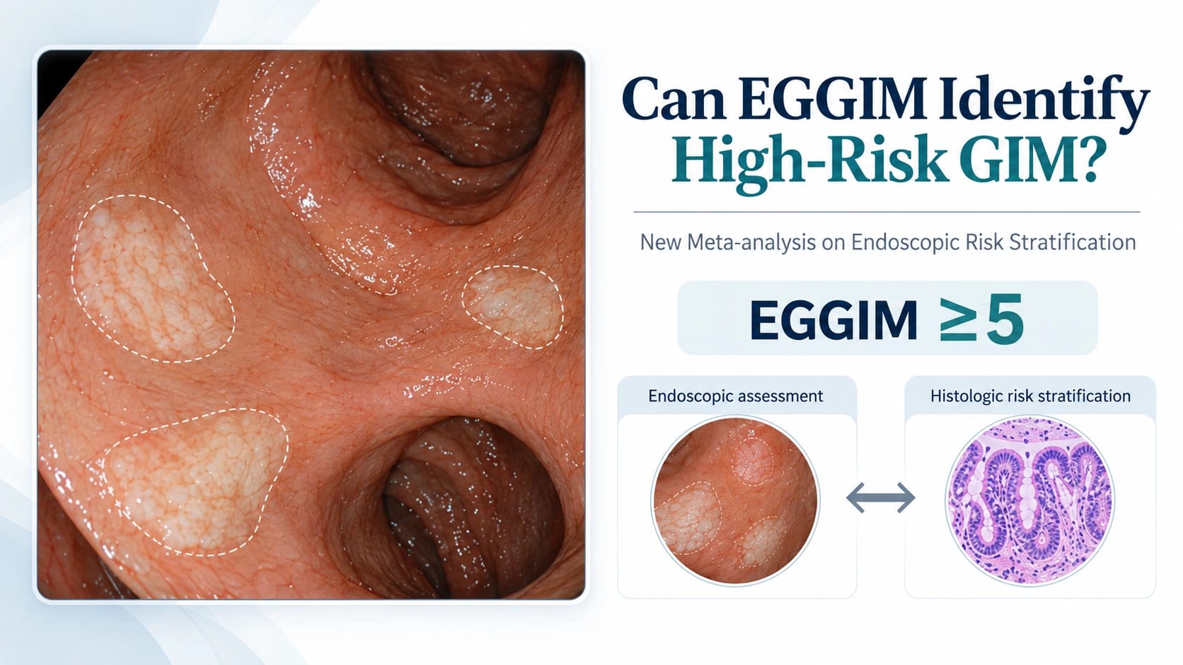 Can EGGIM Reliably Identify Extensive Gastric Intestinal Metaplasia? New Meta-analysis Supports Real-Time Endoscopic Risk Stratification