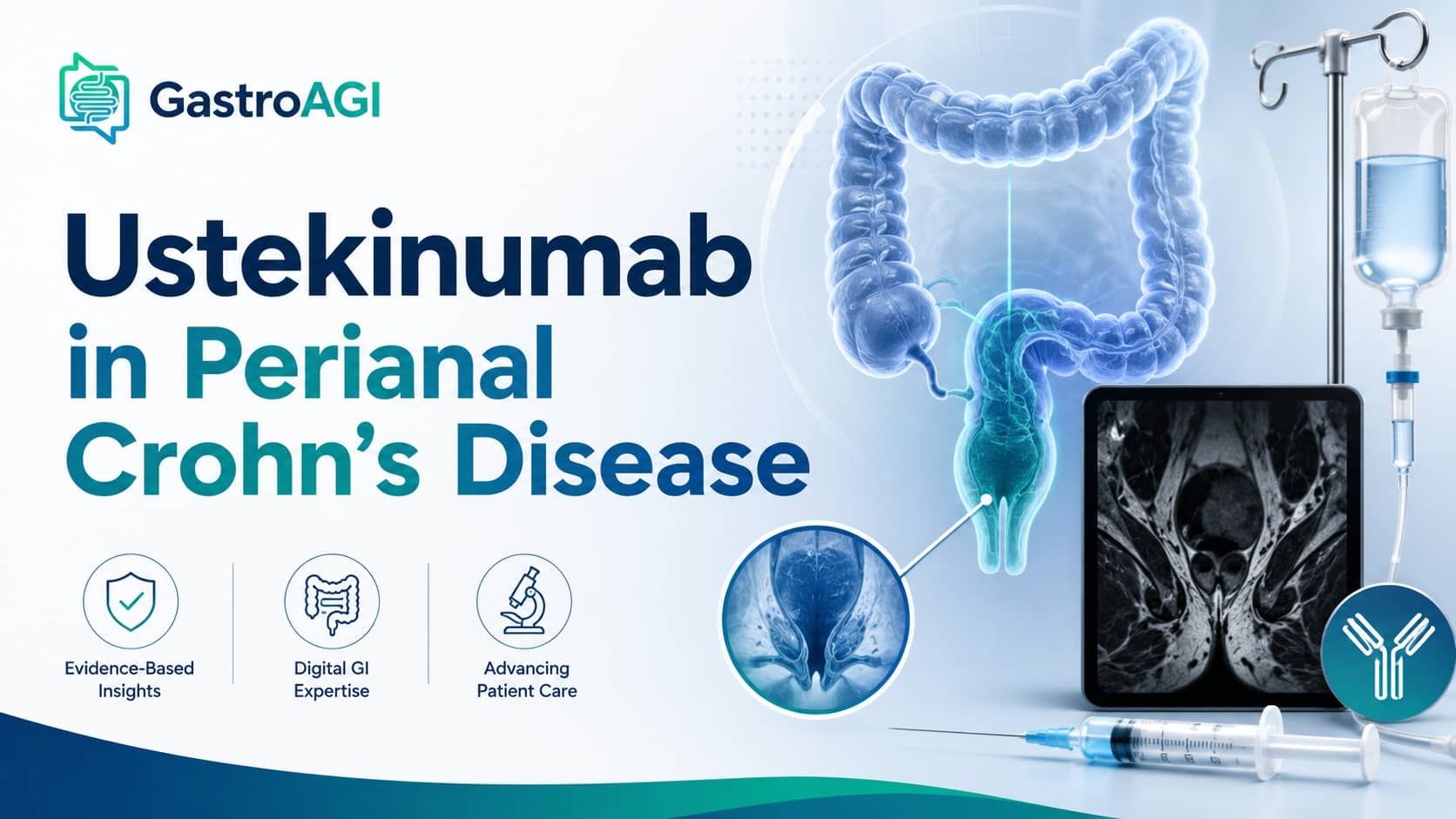 Ustekinumab for Fistulising Perianal Crohn’s Disease: What the GETAID Trial Adds to Clinical Practice
