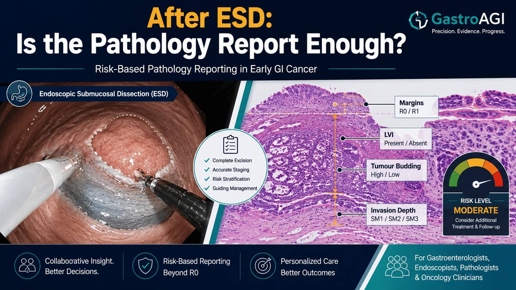 Risk-Based Pathology Reporting After ESD for Early GI Cancer: Why Standardisation Matters