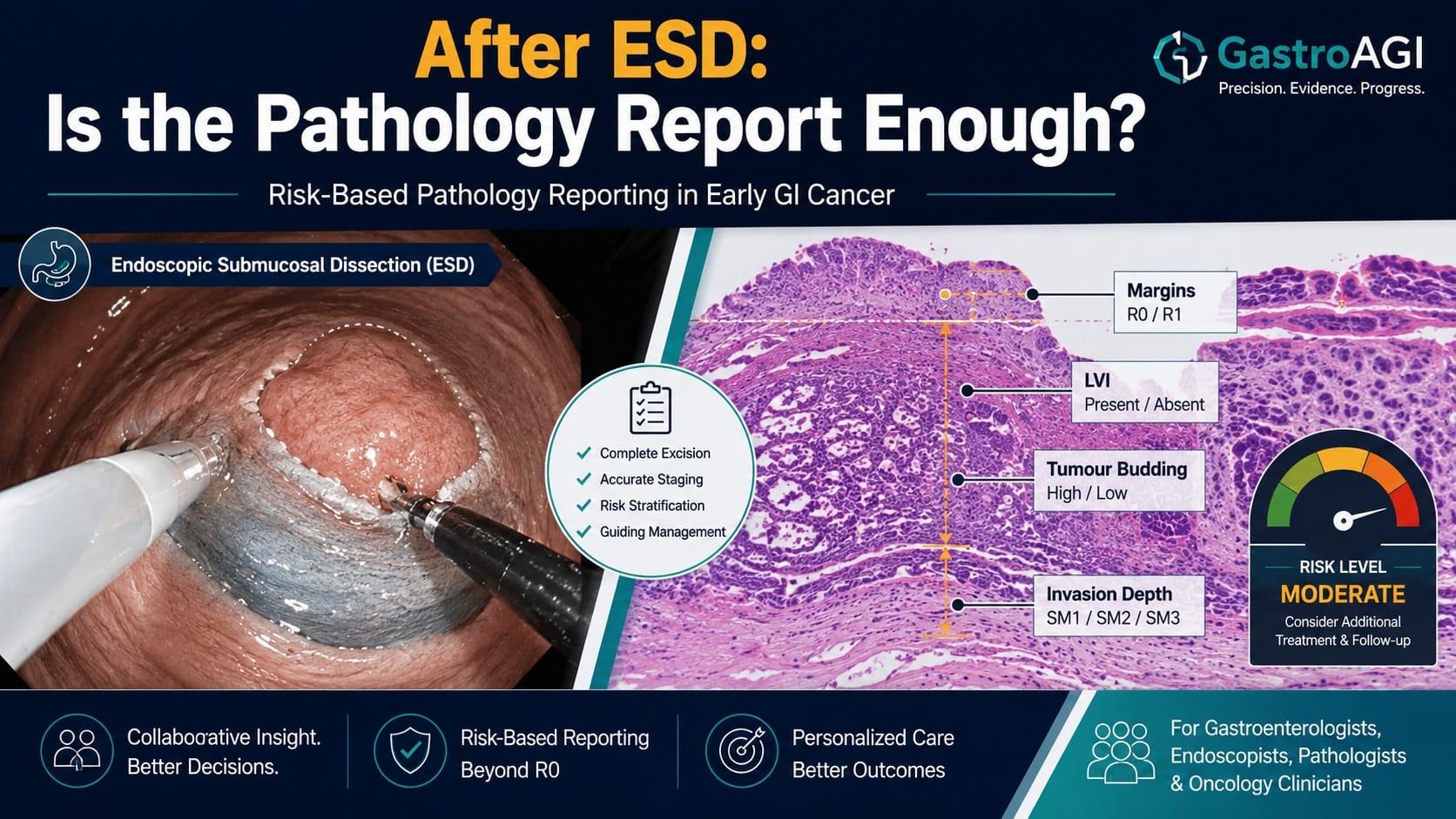 Risk-Based Pathology Reporting After ESD for Early GI Cancer: Why Standardisation Matters
