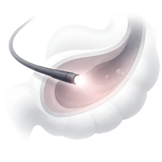 Endoscopy