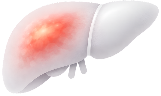 Hepatitis