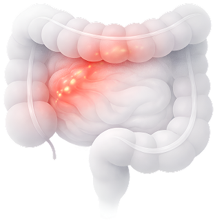 IBD